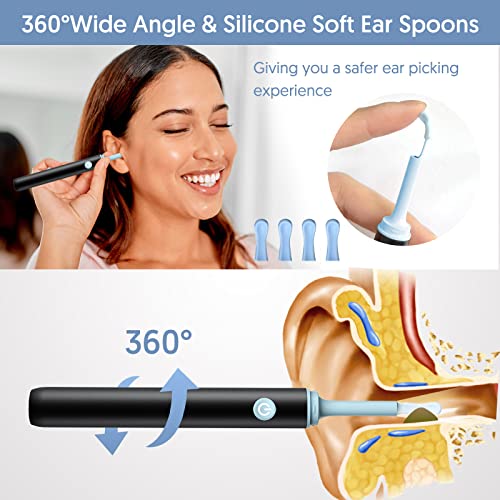 Find B - Smart Visual Ear Wax Removal with Camera