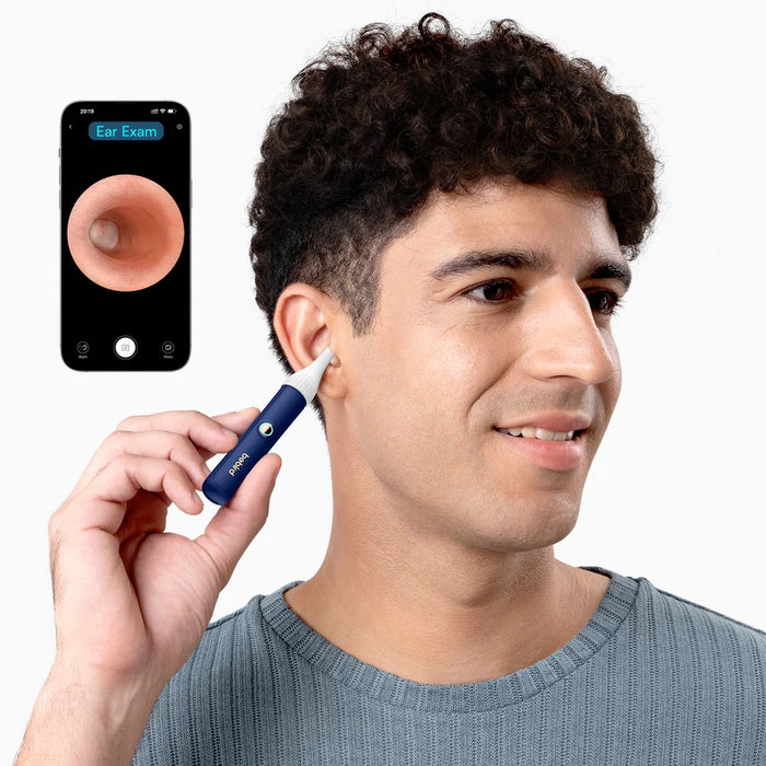 BEBIRD Earsight Plus E33R Ear Cleaning Camera Wax Removal Tool kit Safe & Painless Design