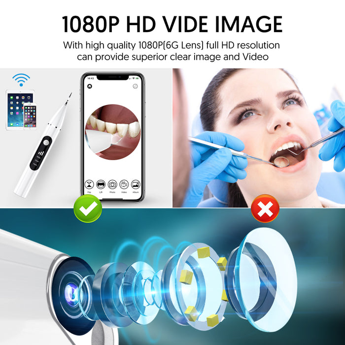 Visual Ultrasonic Scaler
