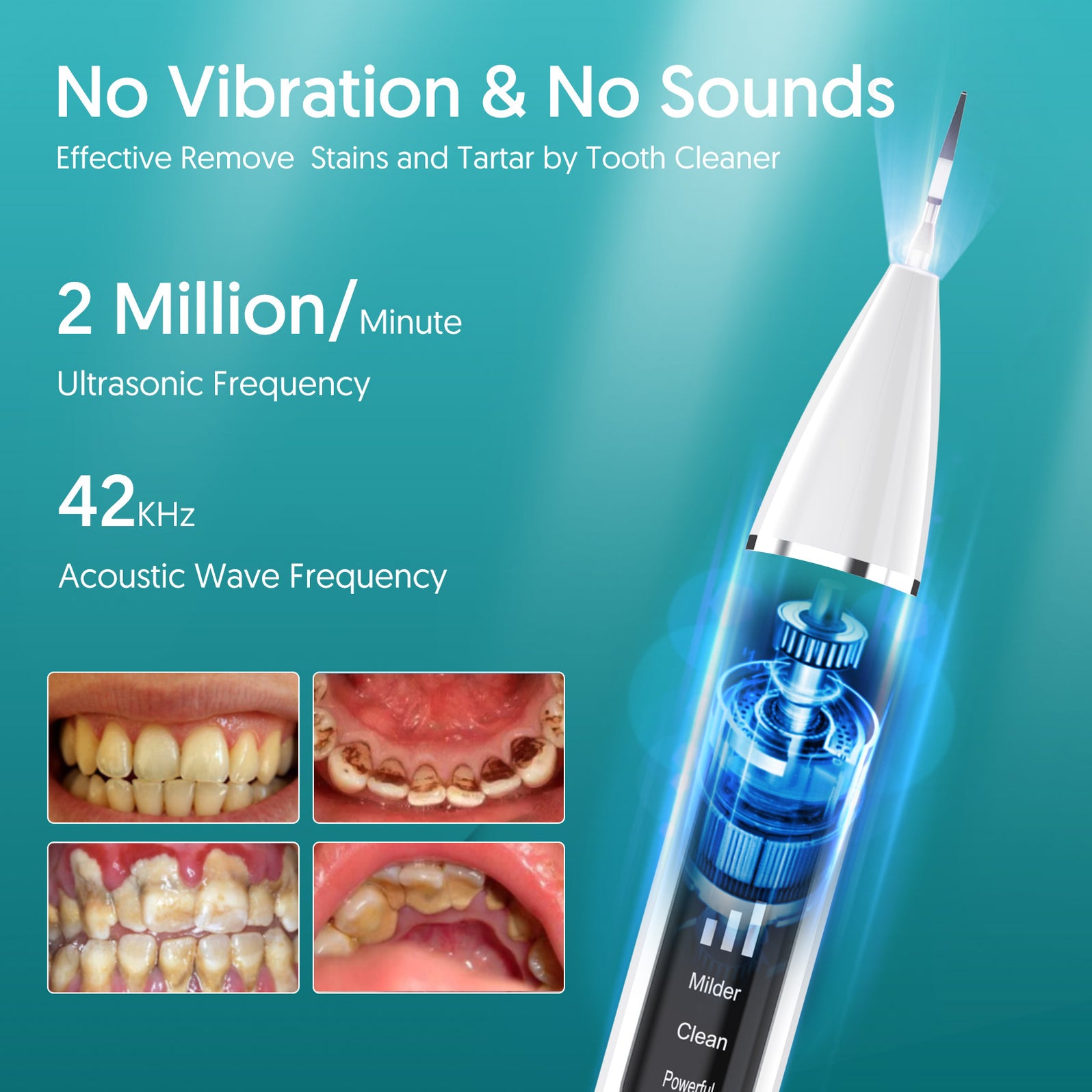 Visual Ultrasonic Scaler — AvatarControls