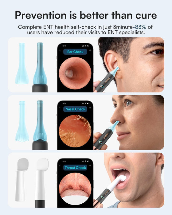 Bebird Earsight Ultra - 2K Ear Wax Removal Tool Camera Otoscope Visual Ear Cleaning Kit