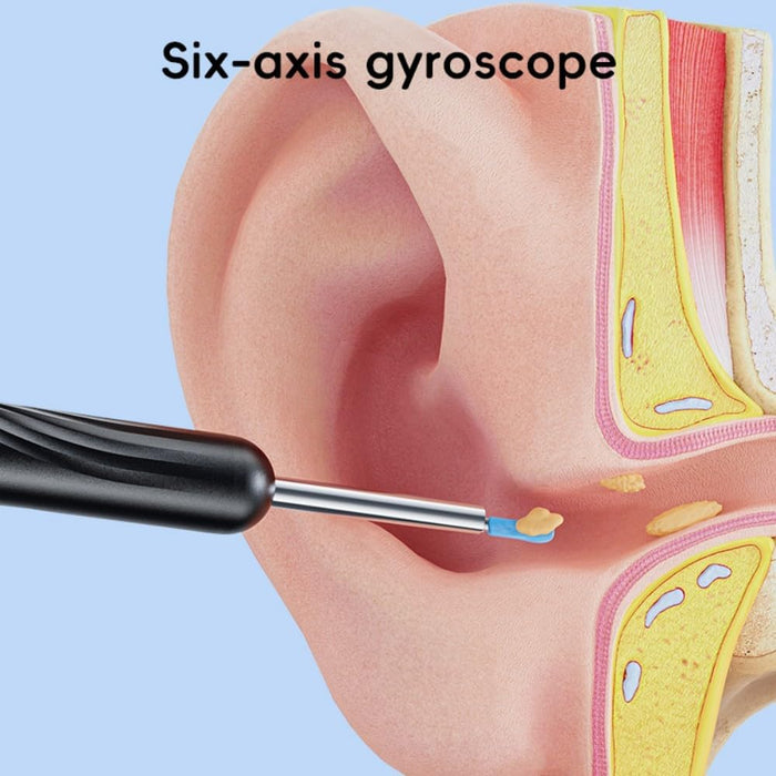 B8 Ear Wax Removal with 1080P HD Camera Otoscope Ear Cleaning Kit