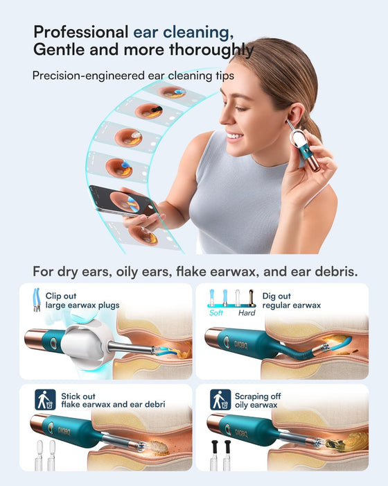 Bebird Earsight Ultra - Ear Wax Removal Tool Camera Otoscope Visual Ear Cleaning Kit