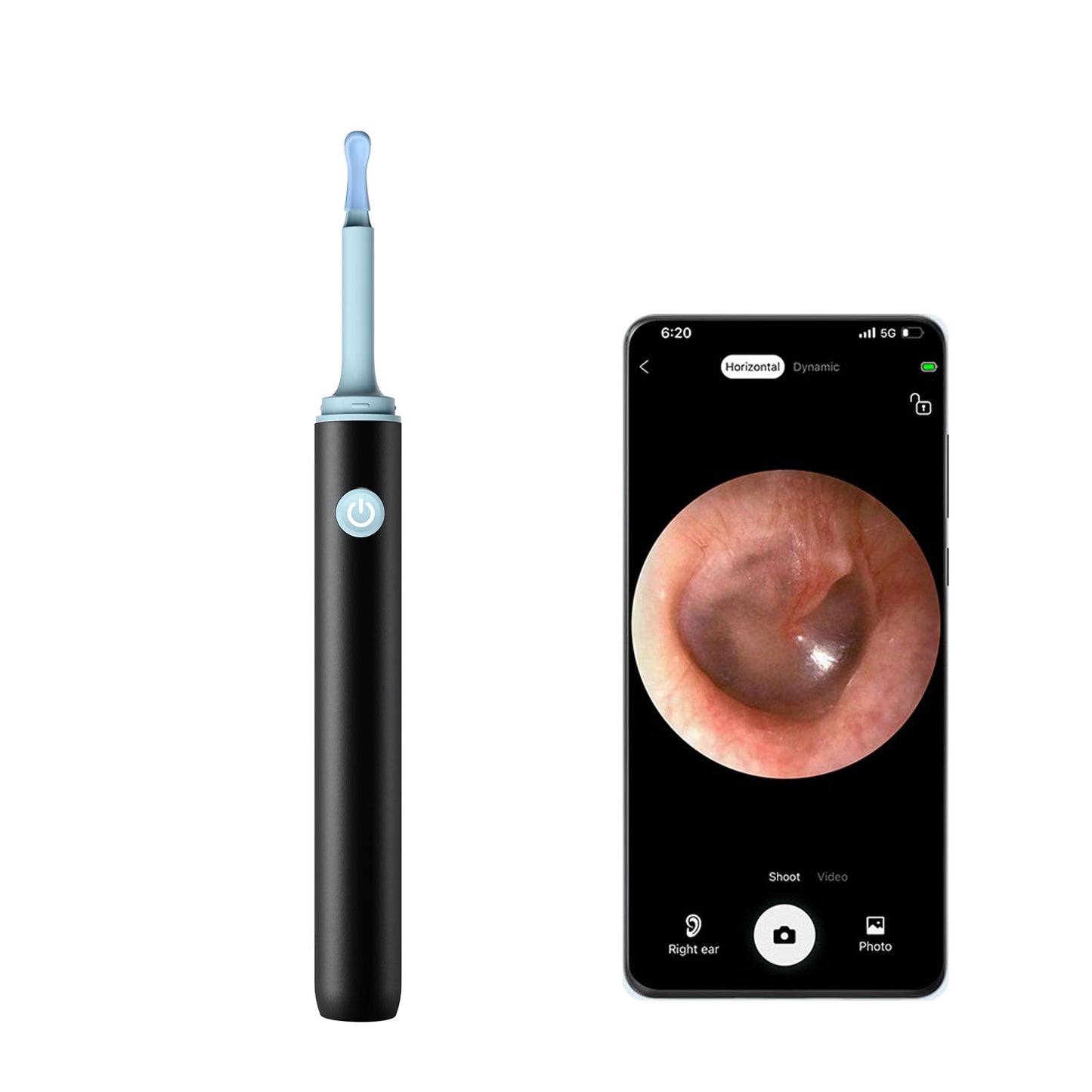 Find B - Smart Visual Ear Wax Removal with Camera