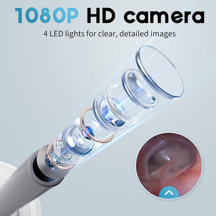 Otoscope Ear Camera with 1.21” Screen, 1080P Ear Scope with 4 LED Lights, Otoscope Camera for Adults Kids and Pets, Support Photo & Video