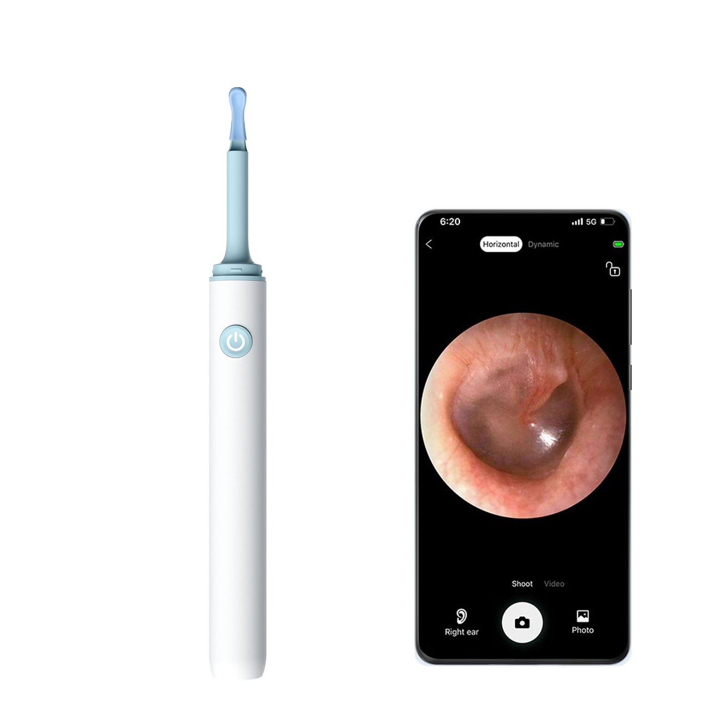 Find B - Smart Visual Ear Wax Removal with Camera